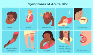 symptoms of acute HIV