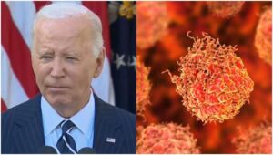 Prostate cancer