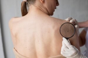 Why is skin cancer more common in Australia