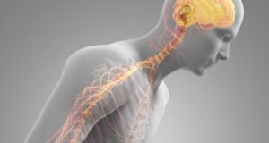 Parkinson Disease