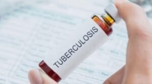 IISc 3D Model May Speed Up TB Cures