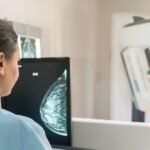 मैमोग्राफी (Mammography)