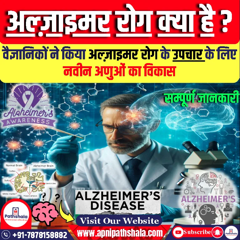 अल्ज़ाइमर रोग