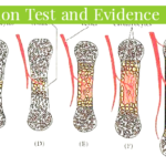 अस्थि अस्थिकरण परीक्षण क्या है?