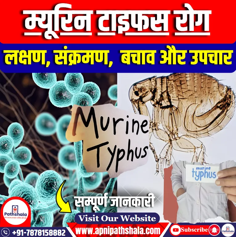Murine Typhus