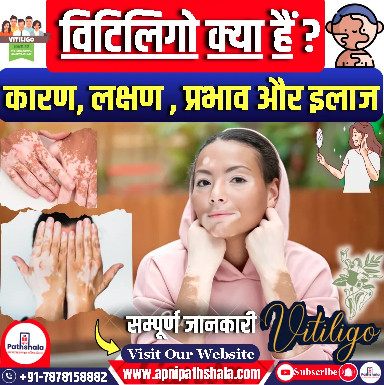 विटिलिगो