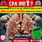 क्रोनिक पल्मोनरी एस्परगिलोसिस