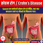क्रोहन रोग / Crohn’s Disease