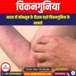 चिकनगुनिया (Chikungunya) | UPSC