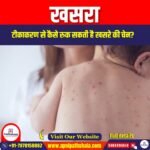 खसरा (Measles) | UPSC Preparation