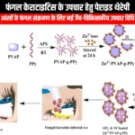 फंगल केराटाइटिस के उपचार हेतु पेप्टाइड थेरेपी (Peptide therapy for the treatment of fungal keratitis) | UPSC