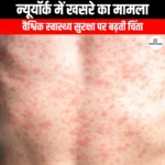 न्यूयॉर्क में खसरे का मामला (Measles case in New York) Apni Pathshala