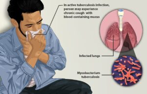 World Tuberculosis Day 2026