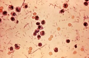 Shigellosis outbreak in Kerala