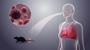 Hanta virus