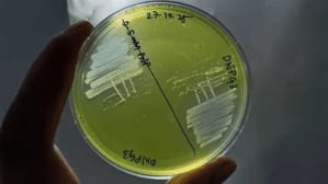 Brachybacterium Netaji Discovery