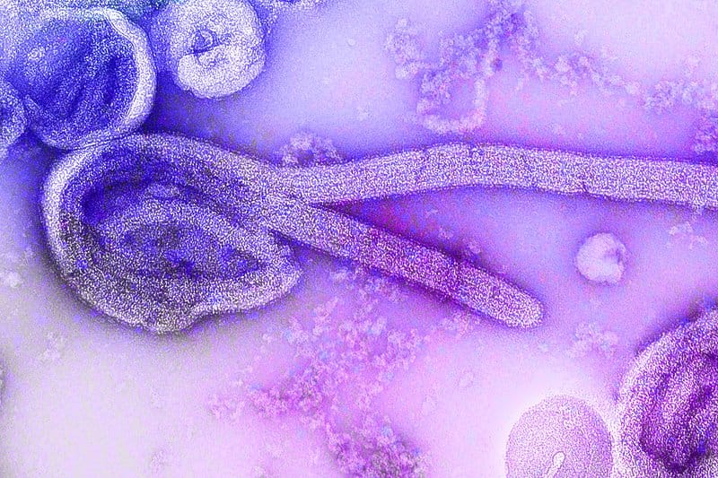 Bundibugyo Virus Diagnostic Test
