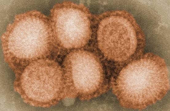Bengaluru H1N1 Outbreak