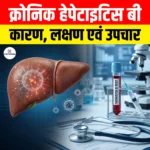 Chronic Hepatitis B: कारण, लक्षण एवं उपचार